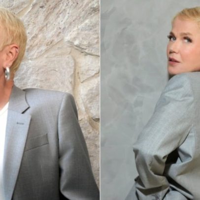 Xuxa celebra resultado de transplante de cabelo e quando considerar o procedimento