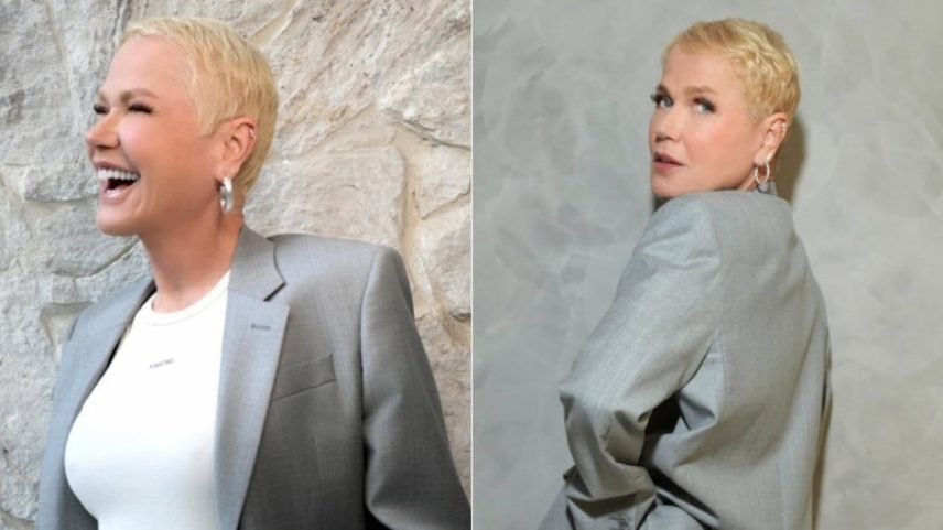 Xuxa antes e depois do procedimento