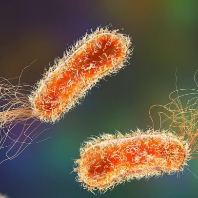 Pseudomonas aeruginosa é encontrada em lotes suspensos da Ypê