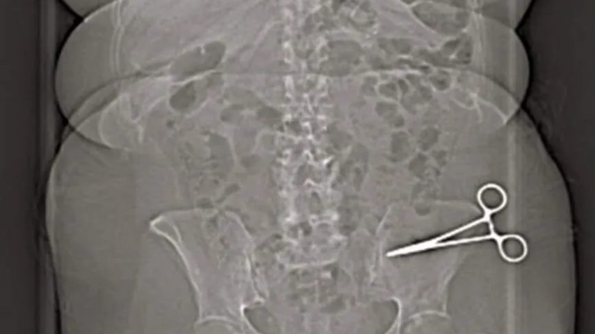 Paciente passou por cirurgia em outubro de 2025