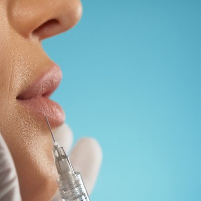 Conselho Federal de Medicina proíbe uso estético de PMMA em todo o Brasil