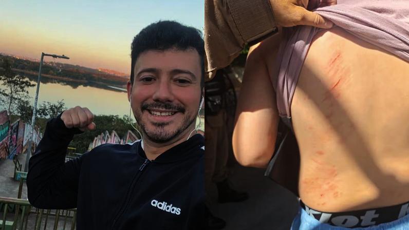 O adolescente sofreu diversos ferimentos pelo corpo, incluindo uma fratura facial