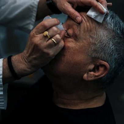 Uso de corticoides pode elevar risco de glaucoma, afirmam entidades médicas