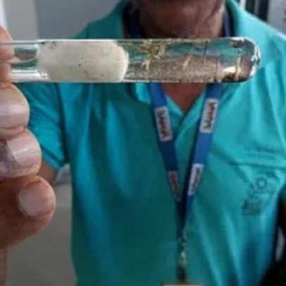 Bahia registra cerca de 8 mil casos prováveis de dengue em 2026