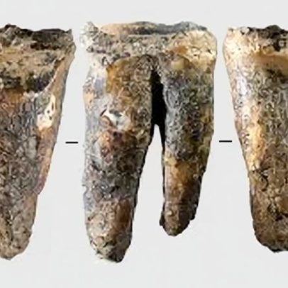 Dente encontrado em caverna siberiana revela cirurgia dentária pré-histórica