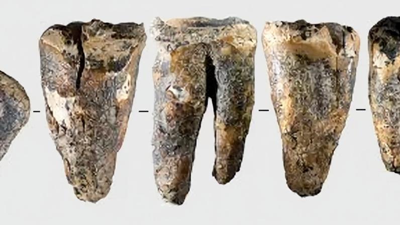Vistas de ângulos diferentes de molar de Neandertal descoberto em caverna na Sibéria 13 de maio de 2026 REUTERS/Zubova et al., 2026, PLOS One