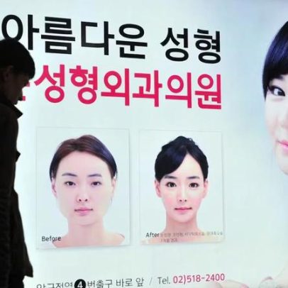 Lasers de lifting facial impulsionam turismo médico para Coreia do Sul