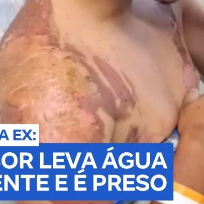 Mulher reage a invasão do ex com água fervente; suspeito autuado na maca