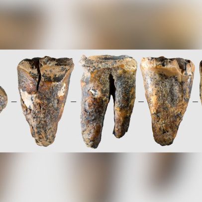 Dente em caverna na Sibéria revela cirurgia em neandertal