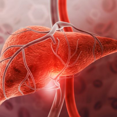 Hepatologista aponta sinais de que cúrcuma pode afetar o fígado