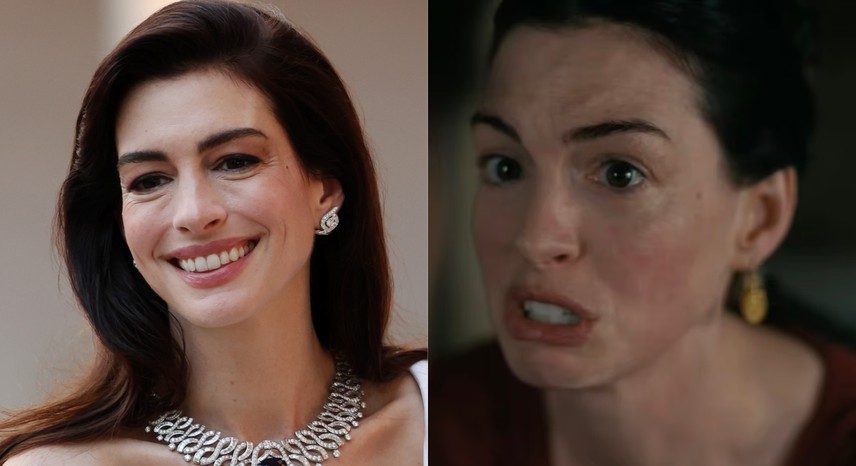 Anne Hathaway com rosto congelado em trailer desperta debate sobre estética