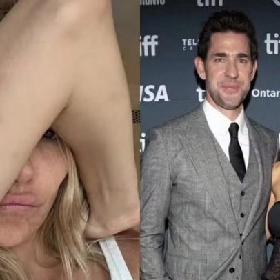 Atriz exibe hematomas no set após confessar se atirou no marido de Emily Blunt