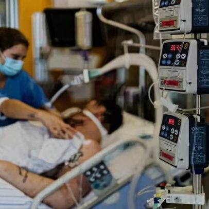 Estudo valida tecnologia brasileira para monitorar pacientes neurocríticos em UTIs