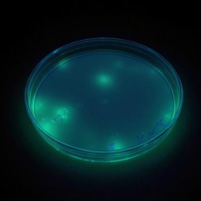 Anvisa identifica Pseudomonas aeruginosa em 100 lotes de Ypê na inspeção de abril
