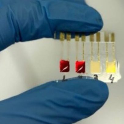 USP desenvolve biossensor que detecta câncer de pâncreas em 7 minutos