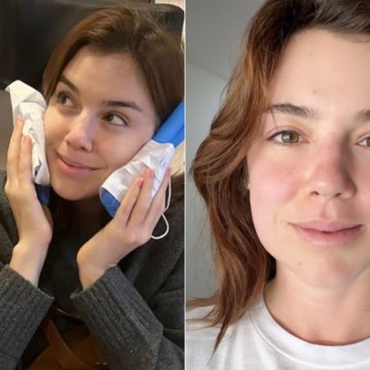 Alice Wegmann mostra retirada dos sisos e brinca: estou igual ao Kiko