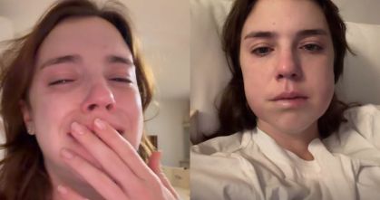 Alice Wegmann mostra rosto inchado após retirada de sisos
