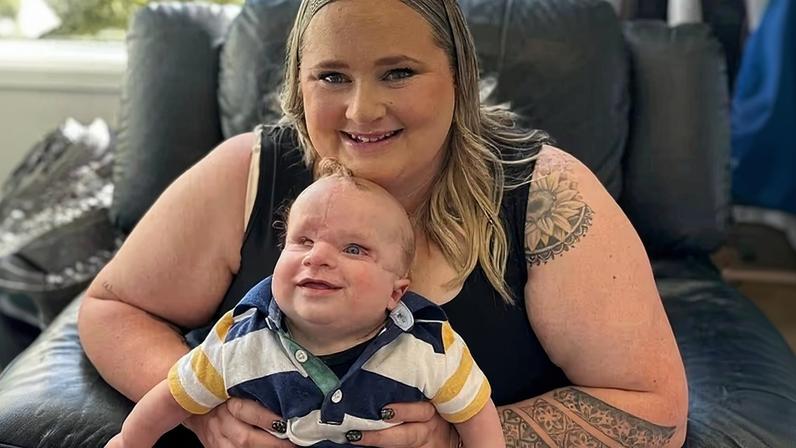 Maddicyn Brokenshire ficou extremamente preocupada ao descobrir que seu filho, Ollyver, estava lutando contra a Síndrome da Banda Amniótica (SBA).