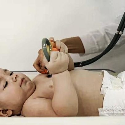 Pressão alta ao nascer aumenta risco de hipertensão na infância