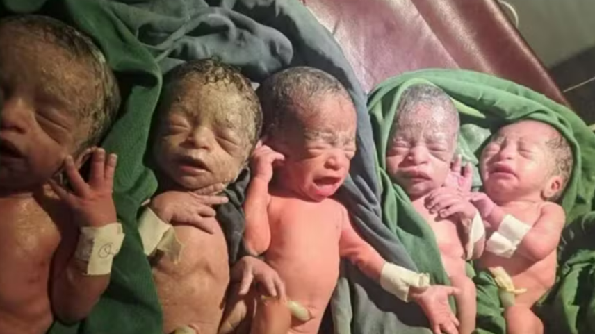 Médico revelou que os recém-nascidos pesavam entre 1,3 kg e 1,4 kg no momento do parto, realizado por cesariana