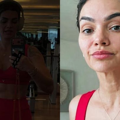 Kelly Key revela uso de hormônios sintéticos e afirma não promover estética