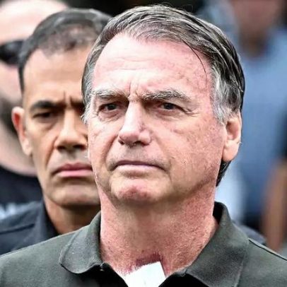 Bolsonaro evolui bem após cirurgia e iniciará reabilitação, afirma hospital