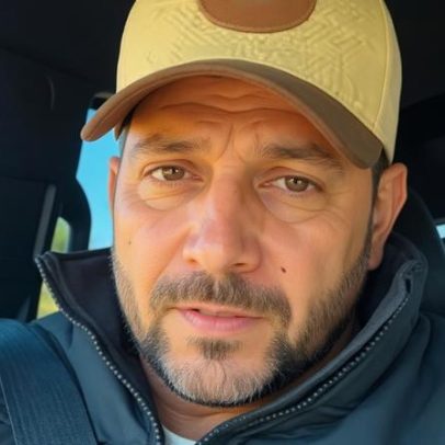 Ex-BBB Caio Afiune nega ligação entre alergias e produtos da Ypê