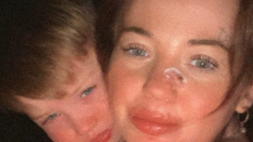 Danni-Lea Sandland descobriu que seu filho Clay tem a mesma doença rara que ela