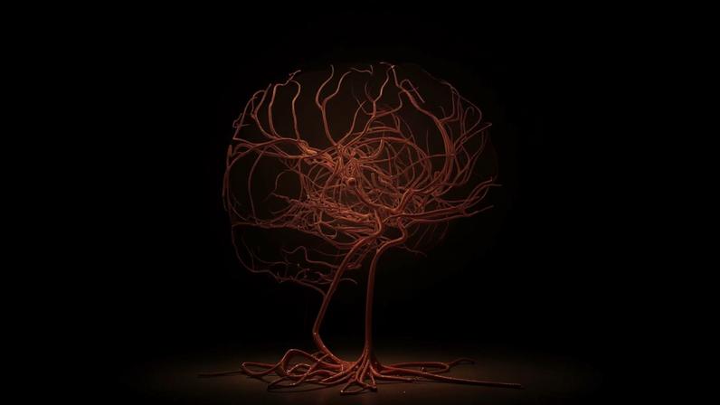 Ilustração de um aneurisma sacular (em forma de baga) na artéria cerebral média, destacando a patologia vascular e o risco de acidente vascular cerebral. Metrópoles