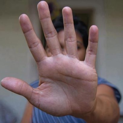 Homem que ateou fogo na companheira não responderá por feminicídio