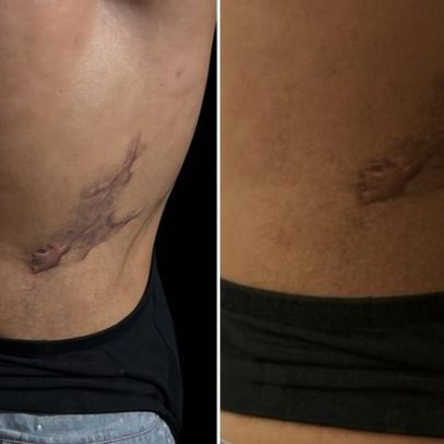Pacientes relatam lesões após cirurgias com médico da jovem morta