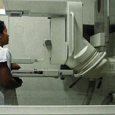 Anvisa aprova nova opção de medicamento para tratamento do câncer de mama