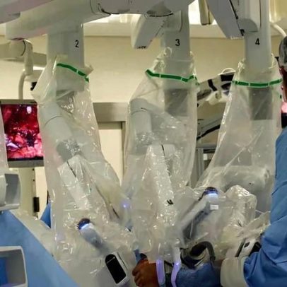 Cirurgia robótica passa a ter cobertura obrigatória pelos planos de saúde