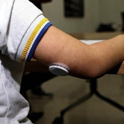 Projeto de proteção para 600 mil brasileiros com diabetes tipo 1 vai virar lei