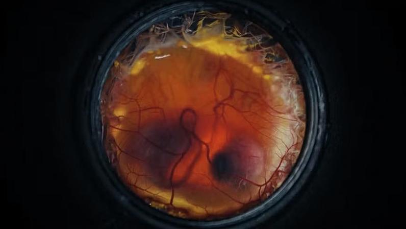 O ovo artificial possui uma estrutura de casca em forma de treliça que incorpora uma membrana à base de silicone. Essa casca artificial reproduz a capacidade de transferência de oxigênio de uma casca de ovo natural