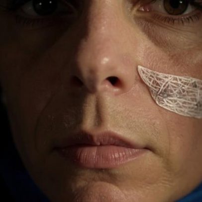Criança com dente nascendo no nariz surpreende pela condição rara