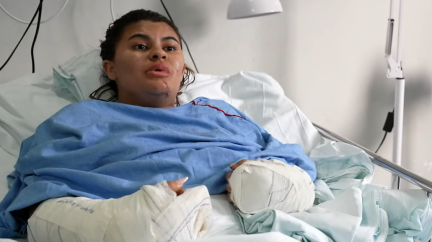 Ana Clara teve as mãos decepadas pelo ex-cunhado