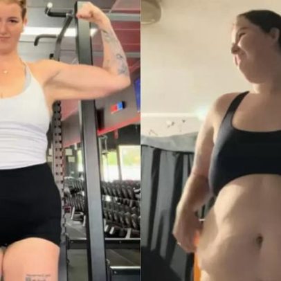 Jovem perde 65 kg em um ano e meio sem cirurgia bariátrica nem canetas
