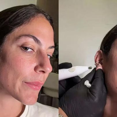 Mari Gonzalez mostra procedimento para fechar orelha rasgada