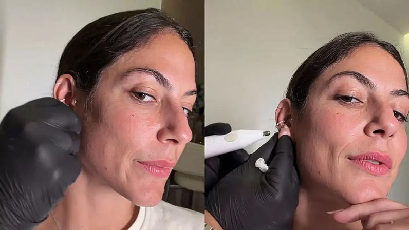 Mari Gonzalez faz procedimento para fechar orelha rasgada