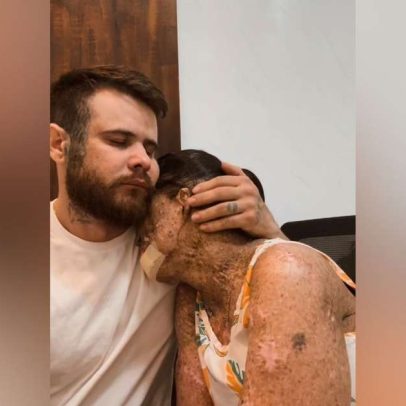 Influencer com doença rara revela diagnóstico terminal de câncer