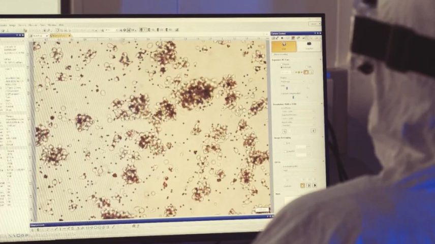 Terapia Car-T é esperança para pacientes com câncer — Foto: TV Globo/Reprodução