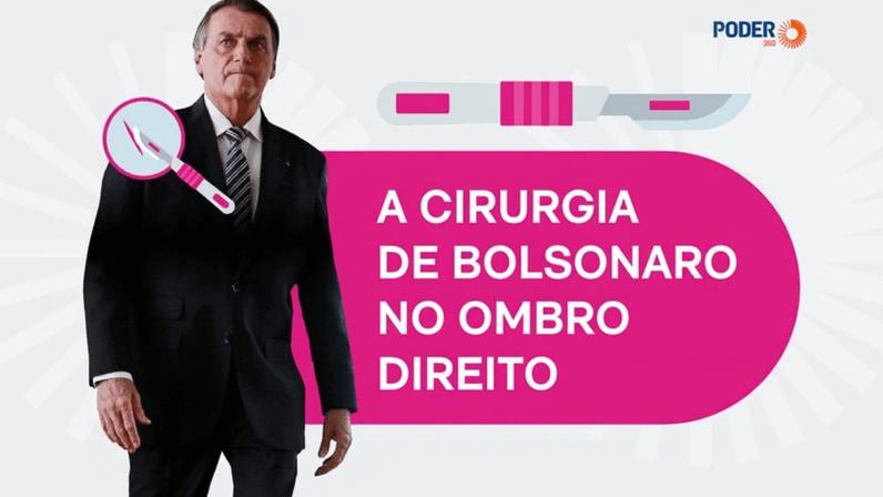 A recomendação médica é que o procedimento seja feito por via artroscópica, técnica minimamente invasiva