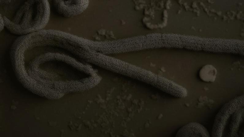 EUA impõem restrições após avanço do ebola
