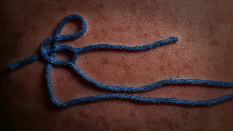 Imagem do vírus do Ebola
