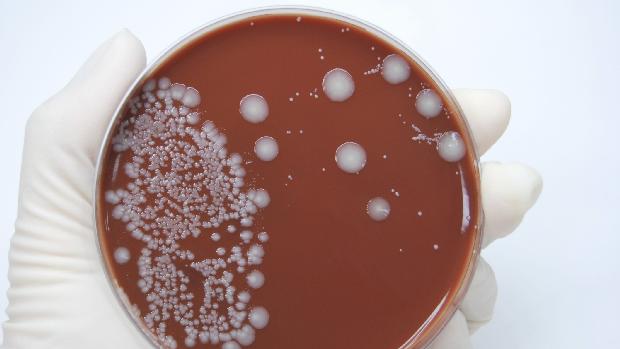 E. coli: um em cada cinco casos não responde ao tratamento com antibióticos padrão (Thinkstock/VEJA/VEJA)