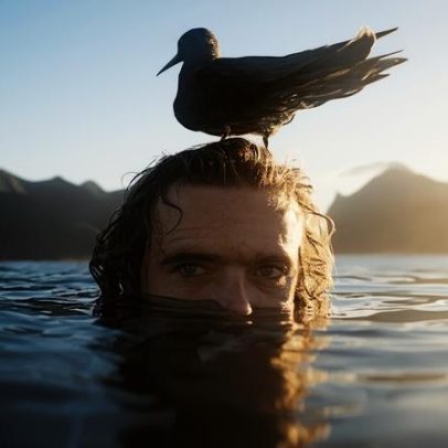 Fotógrafo da WSL mostra lesão após mordida e fará cirurgia