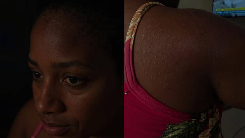 imagem colorida de empregada doméstica agredida por patroa no maranhão