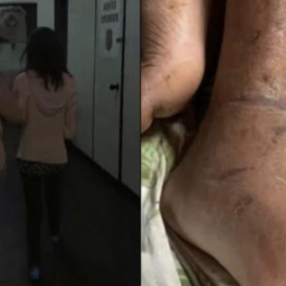 Filho acorrentado pela mãe sofreu três AVCs e ficou sem comida por dias