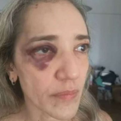 Passageira é agredida por motoboy de app após reclamar de capacete sem viseira no Rio